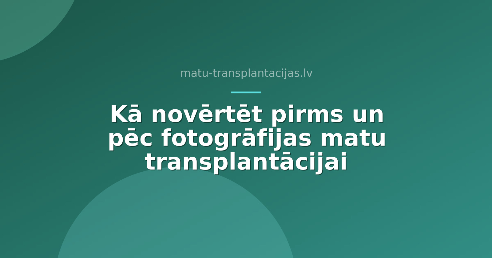 Kā novērtēt pirms un pēc fotogrāfijas matu transplantācijai